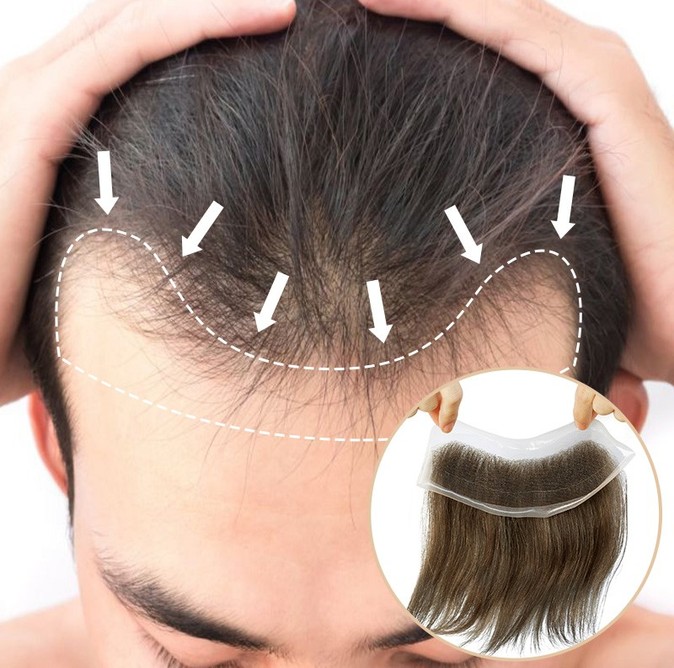 Clearance Lace Hair Patch | 7 5 20 1C