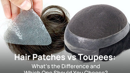 Hair Patches vs Toupees: What’s the Difference and Which One Should You Choose?