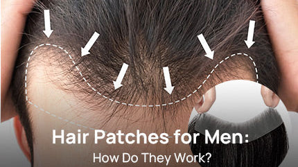 Hair Patches for Men: How Do They Work?