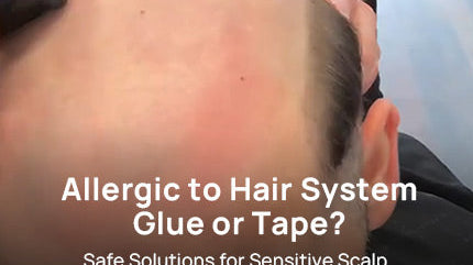 Allergic to Hair System Glue or Tape? Safe Solutions for Sensitive Scalp