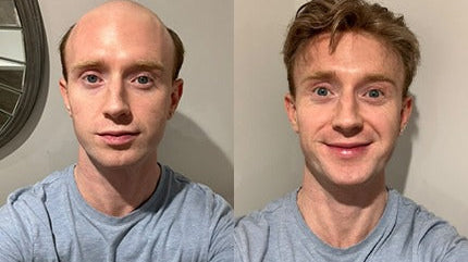 Where the “Fake Hair” Stereotype Comes From