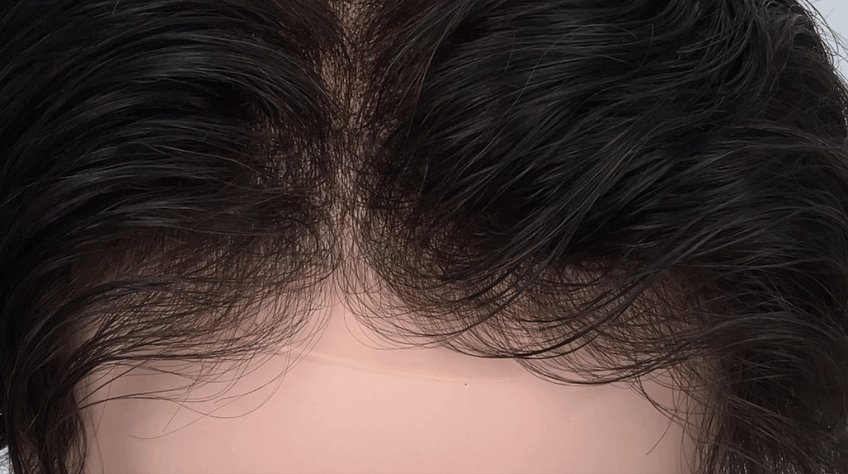 “I don't want more hair. I want a more natural look.”