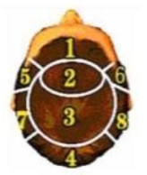 Custom Made Hair System