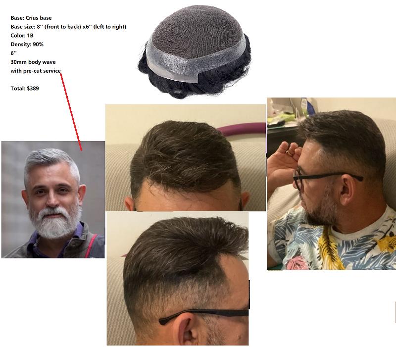 Custom Made Hair System