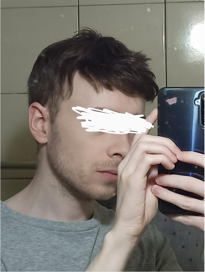 Custom Made Hair System