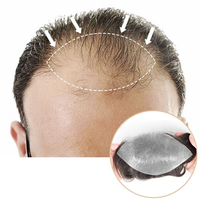 Custom Made Hair System