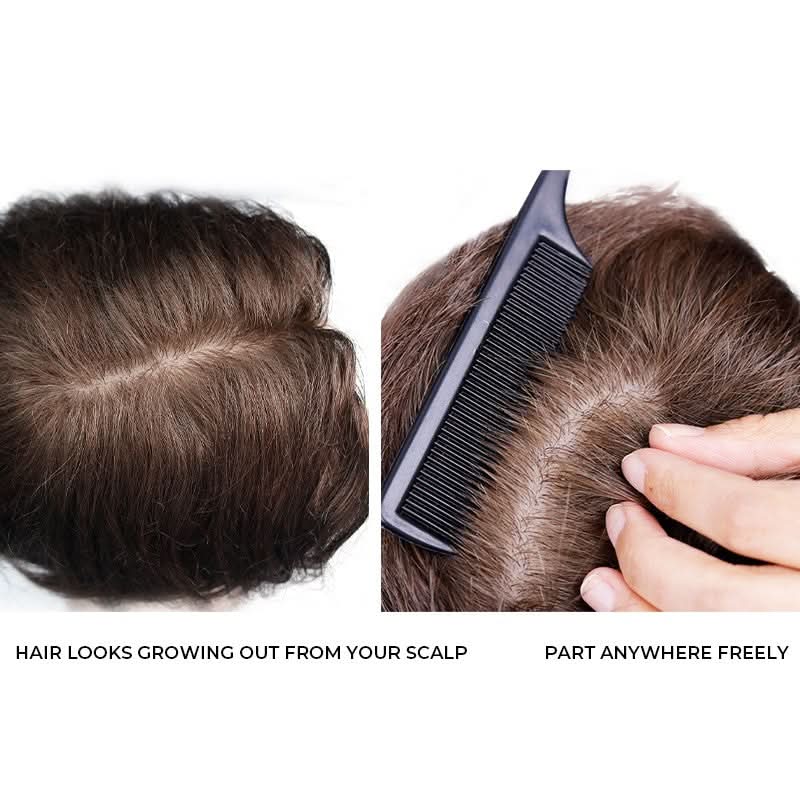 Tyler Hair System for Men | Unmatched Natural Scalp Appearance | Long-lasting for Up to a Year