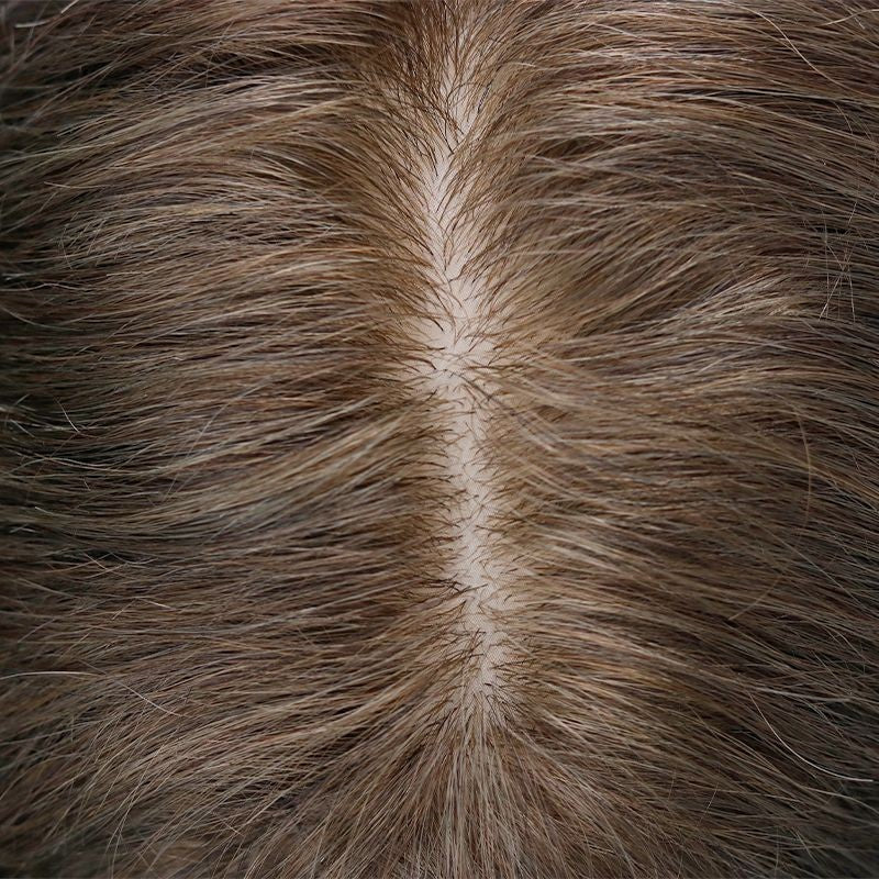 Tyler Hair System for Men | Unmatched Natural Scalp Appearance | Long-lasting for Up to a Year