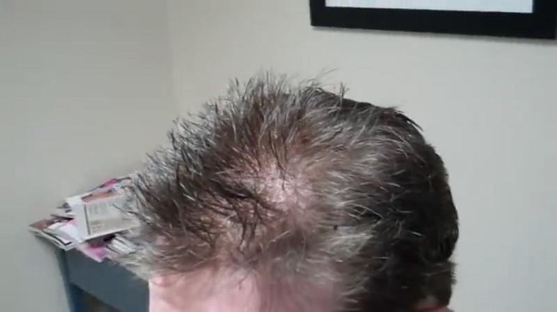 Custom Made Men's Hair System