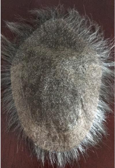 Custom Made Hair System