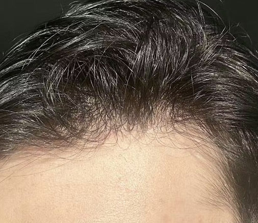 Upgrade Eros 0.02mm-0.03mm Bio Skin