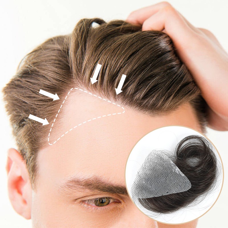 Get Normal Hairline Back with Temple Hair Patches
