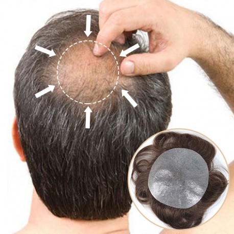 Crown Hair Patch | Covering Thinning or Balding Crown