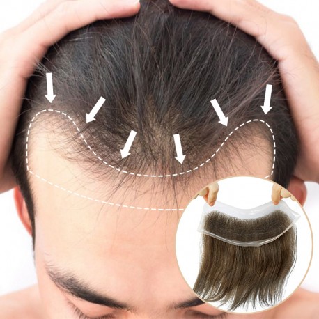 Lace Hair Patch for Men Covering Receding Hairline