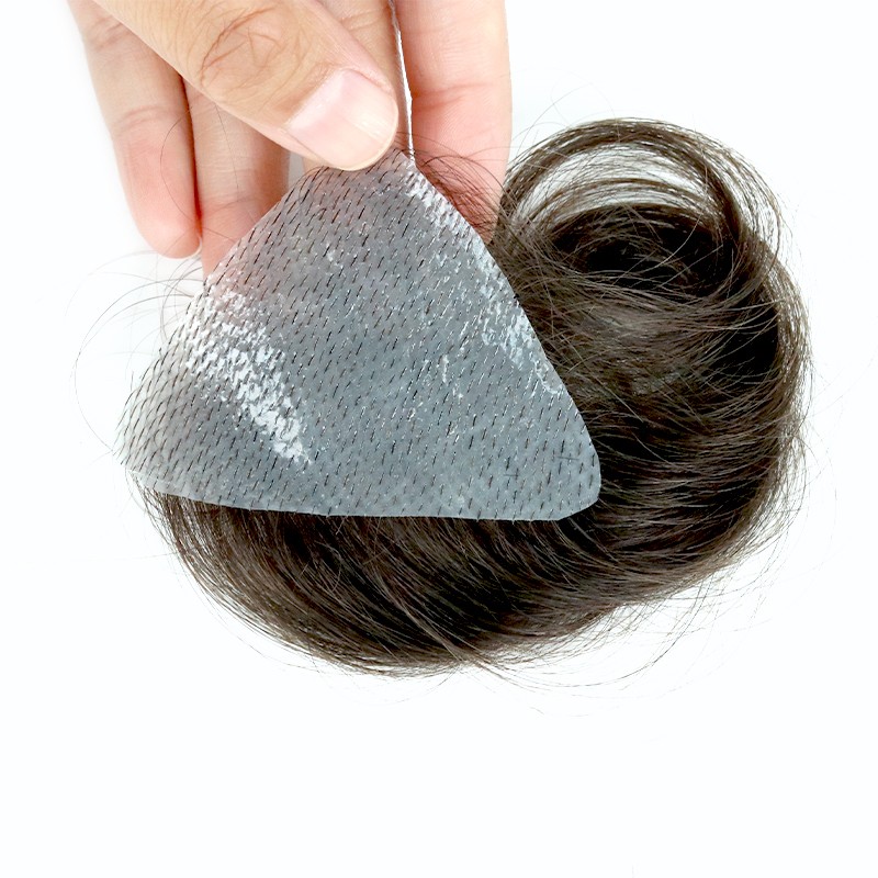 Get Normal Hairline Back with Temple Hair Patches