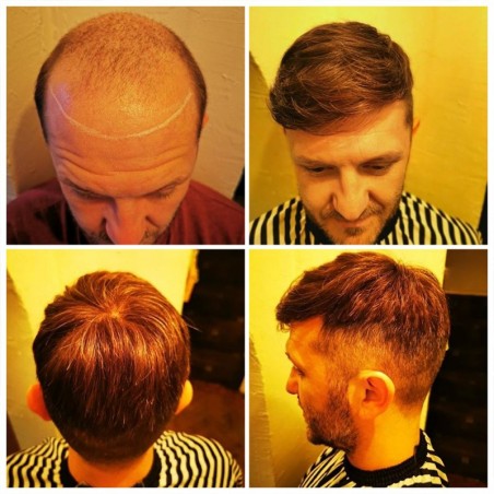 Crius Men's Half Wig | French Lace in Center with Polyskin All Around | Must Have for Traveling Crius Men's Half Wig | French Lace in Center with Polyskin All Around | Must Have for Traveling