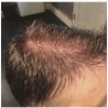 Custom Made Men's Hair System Custom Made Men's Hair System