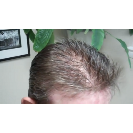 Custom Made Men's Hair System Custom Made Men's Hair System