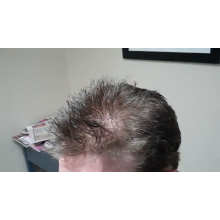 Custom Made Men's Hair System Custom Made Men's Hair System
