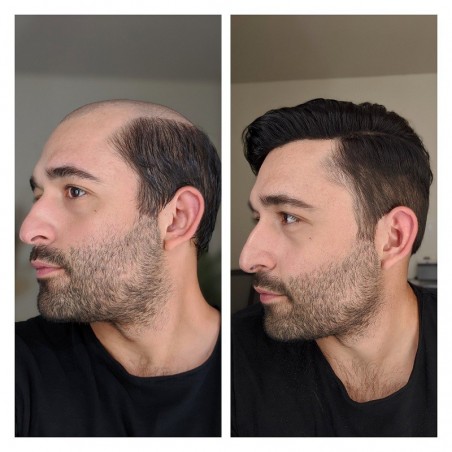 Mirage Toupee for Men |Full Super Thin Skin Base |Celebrities Choice Mirage Toupee for Men |Full Super Thin Skin Base |Celebrities Choice