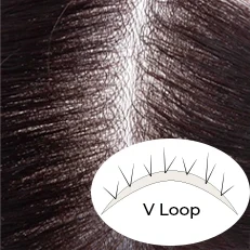 V-Loop