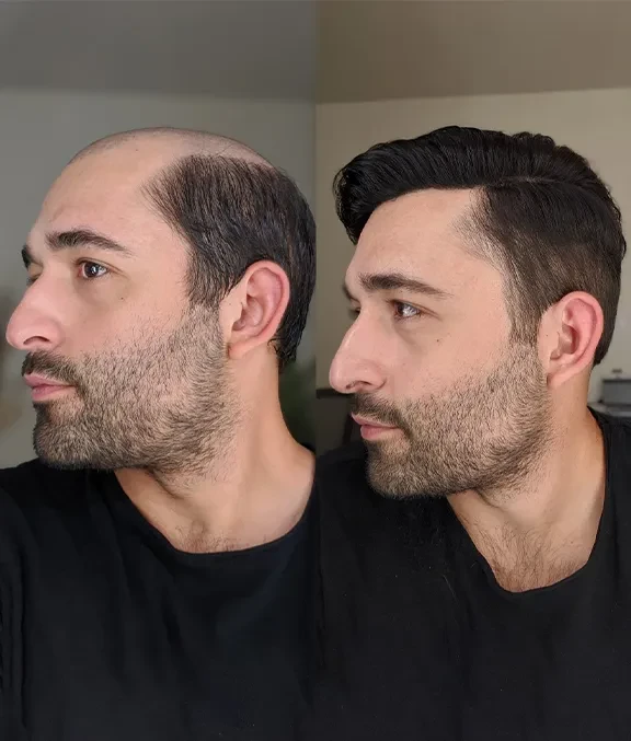 Upgrade Mirage-TP1804