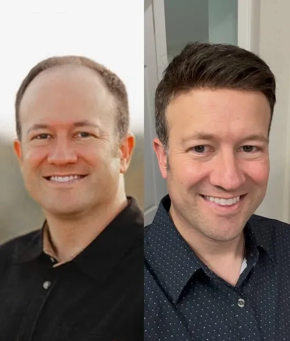 Single-Knotted Mirage – TU2213