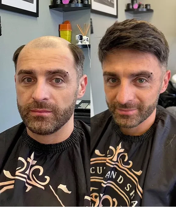 Zeo Mirage – TU2415