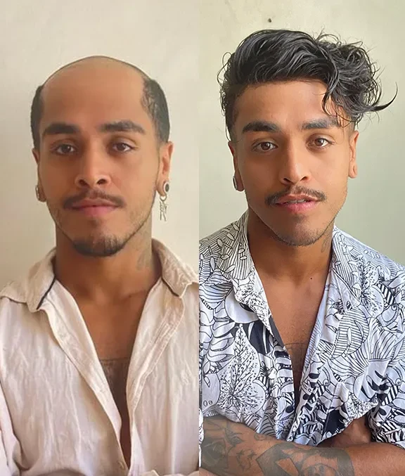 Zeo Knotted Mirage – TU2416