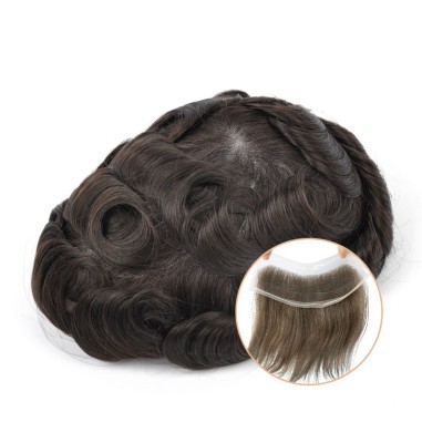 Lace Hair Patch | Covering Receding Hairline In 2 Color