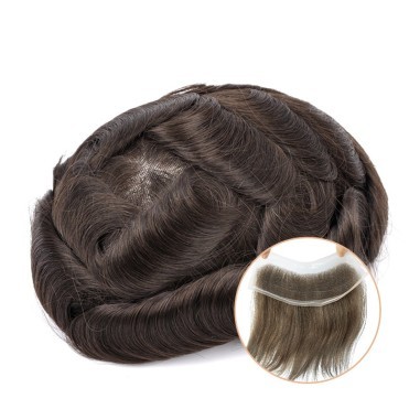 Lace Hair Patch | Covering Receding Hairline In 3 Color