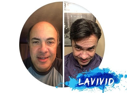 Our Costomer Review of LaVivid European Hair System