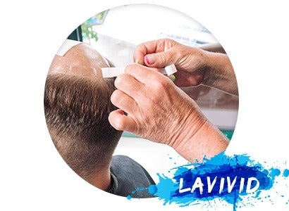 Have You Tried a Qualified Hair Loss Treatment Clinic?