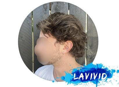 One Month Review of LaVivid Custom Made Hair System