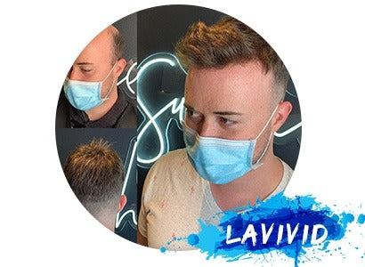 Which One Should I Choose? Full Cap Wigs or Hair Systems?