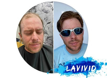 How to Make a Hair System Template