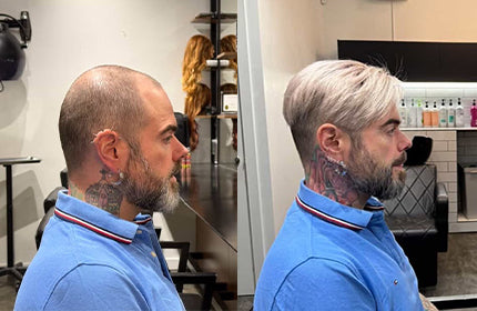 Everything You Need to Know About Hair Systems: FAQs Answered