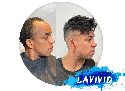 Does Robert Redford Wear a Toupee?