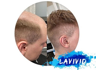 Did Cary grant wear a toupee?