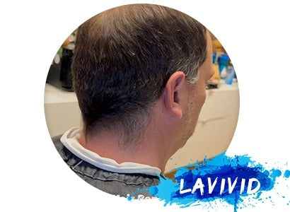 Can hair system be self-installed?