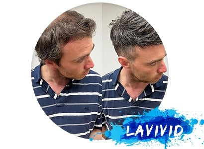 Revolutionizing Toupees for Men: Trends, Attachment, and Maintenance
