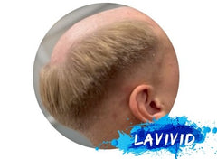 TOP 3 THINGS to do when LOSING YOUR HAIR!