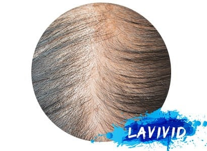 Transform Your Look: Women's Hair Systems for Widening Hair Part