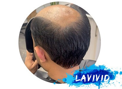 How to Wear a Hair System: A Complete Guide to Non-Surgical Hair Replacement for Men