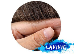 Are You Ready for a Hairline Revolution?