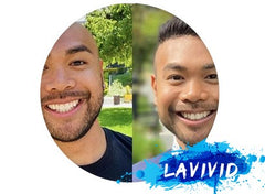 Rebuilding Confidence: How Hair Systems Boost Mental Health