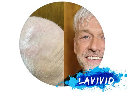 Father’s Day Gift Guide: Hair Systems for the Silver Gentleman