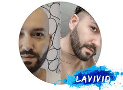 The Secret to a Natural Look: Why a Graduated Hairline Makes All the Difference