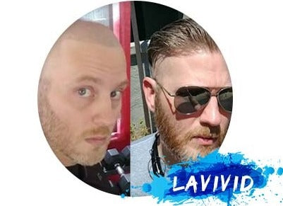 How Long Do Your Hair Systems Last?