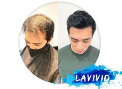 Why Do Some Men’s Toupees Look Unnatural? (And How To Avoid It)